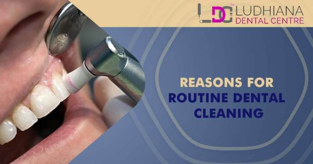 Reasons For Routine Dental Cleaning